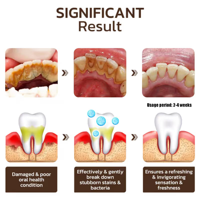 Nicotinamide Whitening Toothpaste